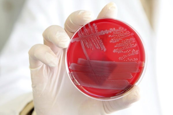 infección por e coli escherichia coli síntomas causas y